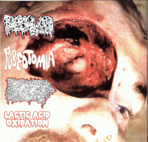 Dissolved : Dissolved - Pubeotomia - Infected Blistered Pissflap - Lactic Acid Oxidation